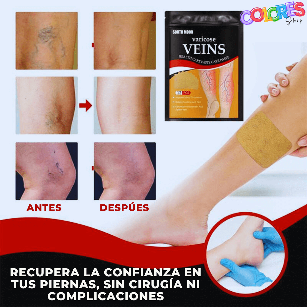 PARCHES PARA EL TRATAMIENTO DE VENAS VARICOSAS/VARICES (24 UNIDADES)