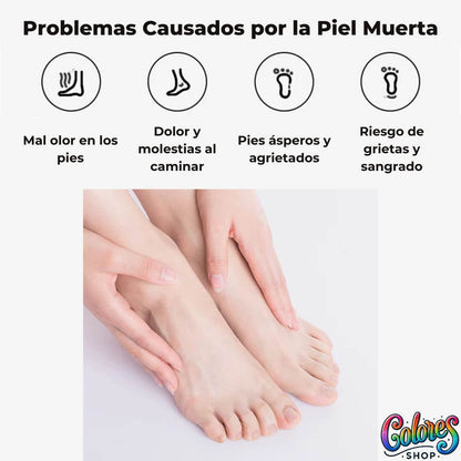 Lima Eléctrica Removedor de Callos Recargable – Elimina durezas sin esfuerzo en casa (A)